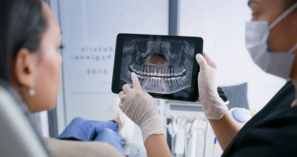 Digital X-Rays treatment at Moonstone Dental Centre in Oakville